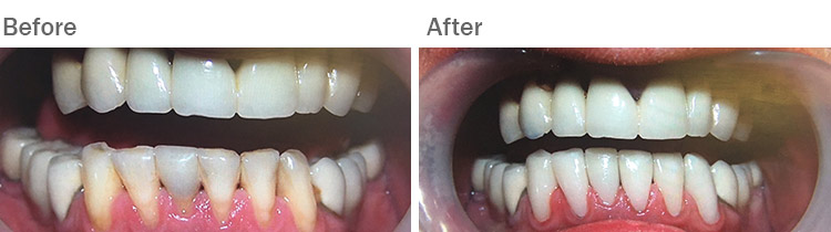 Smile makeover at The Dental Group